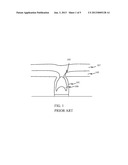 METAL GATE FILL BY OPTIMIZING ETCH IN SACRIFICIAL GATE PROFILE diagram and image