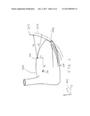 METAL WOOD GOLF CLUB HEAD HAVING EXTERNALLY PROTRUDING WEIGHTS diagram and image