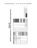 NUCLEIC ACIDS AND CORRESPONDING PROTEINS ENTITLED 158P3D2 USEFUL IN     TREATMENT AND DETECTION OF CANCER diagram and image