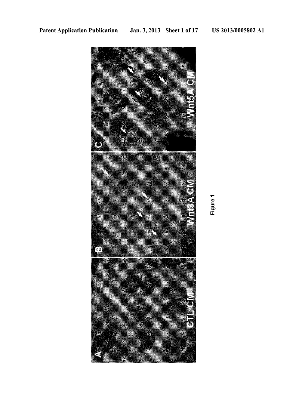 TREATMENT OF WNT/FRIZZLED-RELATED DISEASES - diagram, schematic, and image 02