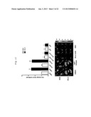 METHODS OF ENHANCING THE RESPONSE TO RADIATION IN TUMOR THERAPY USING     ANTI-DLL4 ANTIBODIES diagram and image