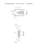 Implantable Sling Systems and Methods diagram and image