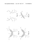 Implantable Sling Systems and Methods diagram and image