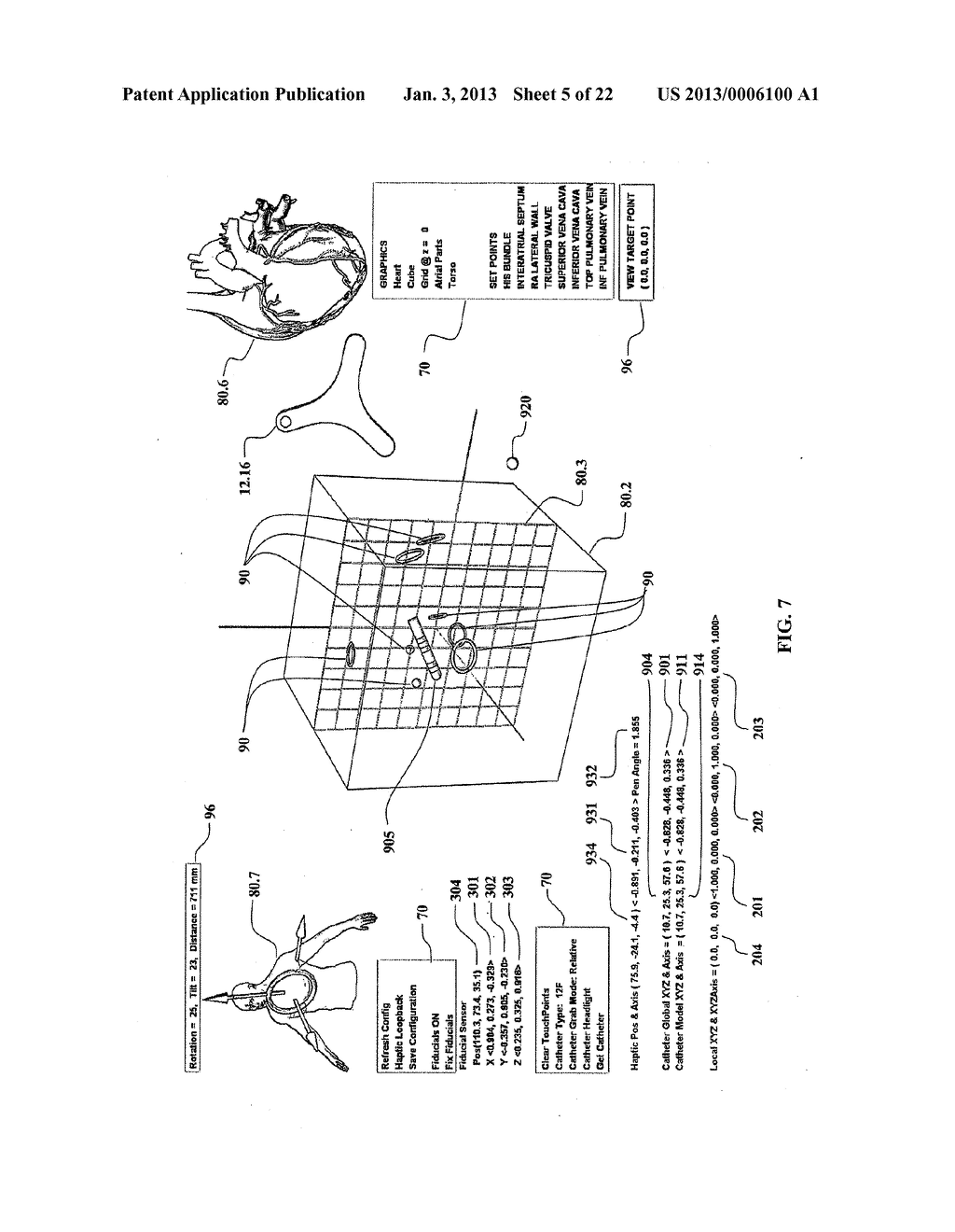 METHOD AND APPARATUS FOR CONTROLLING CATHETER POSITIONING AND ORIENTATION - diagram, schematic, and image 06