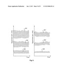 APPARATUS AND METHOD FOR PREDICTION OF RAPID SYMPTOMATIC BLOOD PRESSURE     DECREASE diagram and image