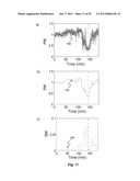 APPARATUS AND METHOD FOR PREDICTION OF RAPID SYMPTOMATIC BLOOD PRESSURE     DECREASE diagram and image