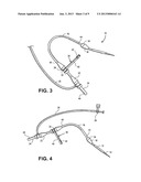 SHEATH diagram and image