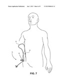 SHEATH diagram and image