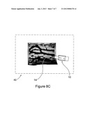 METHOD AND APPARATUS FOR DETECTION OF CATHETER LOCATION FOR INTRAVENOUS     ACCESS diagram and image