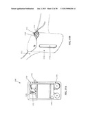 DEVICES AND METHODS FOR TREATMENT OF DAMAGED TISSUE diagram and image