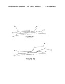 DRUG COATED BALLOON CATHETER diagram and image