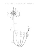 METHODS AND APPARATUSES FOR TISSUE TREATMENT diagram and image