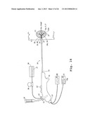 METHODS AND APPARATUSES FOR TISSUE TREATMENT diagram and image