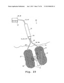 METHODS AND APPARATUSES FOR TISSUE TREATMENT diagram and image