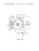 METHODS AND APPARATUSES FOR TISSUE TREATMENT diagram and image