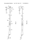 CATHETER WITH VARIABLE ARCUATE DISTAL SECTION diagram and image