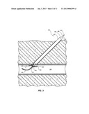 VASCULAR CLOSURE DEVICE HAVING A FLOWABLE SEALING MATERIAL diagram and image