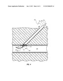 VASCULAR CLOSURE DEVICE HAVING A FLOWABLE SEALING MATERIAL diagram and image