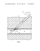 VASCULAR CLOSURE DEVICE HAVING A FLOWABLE SEALING MATERIAL diagram and image