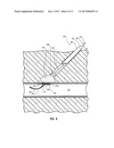 VASCULAR CLOSURE DEVICE HAVING A FLOWABLE SEALING MATERIAL diagram and image