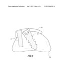 SPINAL PLATE AND METHOD FOR USING SAME diagram and image