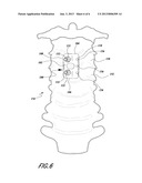 SPINAL PLATE AND METHOD FOR USING SAME diagram and image