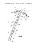 Method of Bending Bone Plate with Bending Tools diagram and image