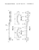 Method of Bending Bone Plate with Bending Tools diagram and image