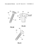 Method of Bending Bone Plate with Bending Tools diagram and image