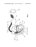 CARDIAC STIMULATOR FOR DELIVERY OF CARDIAC CONTRACTILITY MODULATION     THERAPY diagram and image