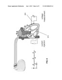 CARDIAC STIMULATOR FOR DELIVERY OF CARDIAC CONTRACTILITY MODULATION     THERAPY diagram and image