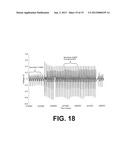 IMPLANTABLE BIOMEDICAL DEVICE LEADS COMPRISING LIQUID CONDUCTORS diagram and image