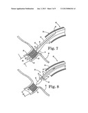 STENT POSITIONING SYSTEM AND METHOD diagram and image