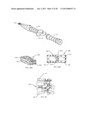 SPINAL FUSION DEVICE diagram and image