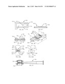 SPINAL FUSION DEVICE diagram and image