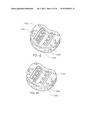 SPINAL FUSION DEVICE diagram and image