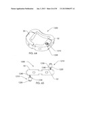 SPINAL FUSION DEVICE diagram and image