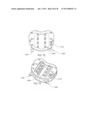 SPINAL FUSION DEVICE diagram and image