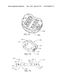 SPINAL FUSION DEVICE diagram and image