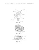 SPINAL FUSION DEVICE diagram and image