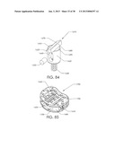 SPINAL FUSION DEVICE diagram and image