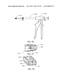 SPINAL FUSION DEVICE diagram and image