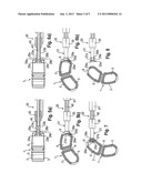 DEVICE FOR INSERTING AN INTERVERTEBRAL IMPLANT INTO A BODY AND SYSTEM     INCLUDING AN INTERVERTEBRAL IMPLANT AND A DEVICE FOR INSERTING SAME diagram and image