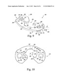 TRIALING SYSTEM FOR A KNEE PROSTHESIS AND METHOD OF USE diagram and image