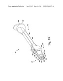 TRIALING SYSTEM FOR A KNEE PROSTHESIS AND METHOD OF USE diagram and image