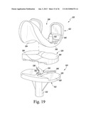 TRIALING SYSTEM FOR A KNEE PROSTHESIS AND METHOD OF USE diagram and image