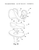 TRIALING SYSTEM FOR A KNEE PROSTHESIS AND METHOD OF USE diagram and image