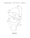 TRIALING SYSTEM FOR A KNEE PROSTHESIS AND METHOD OF USE diagram and image