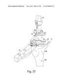 TRIALING SYSTEM FOR A KNEE PROSTHESIS AND METHOD OF USE diagram and image
