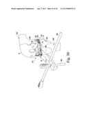 TRIALING SYSTEM FOR A KNEE PROSTHESIS AND METHOD OF USE diagram and image